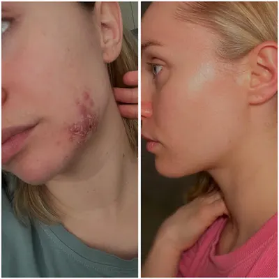 Beauty by Ness Agnieszka Krzystała - kosmetologia holistyczna